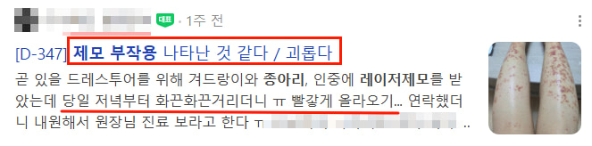 서울명동피부과, 다리 제모 비용보다 먼저 살펴볼 것은?